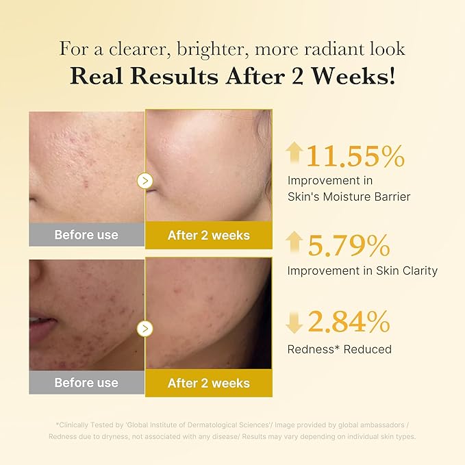 medicube Kojic Acid Turmeric Clarifying & Balancing Capsule Serum for Troubled Skin