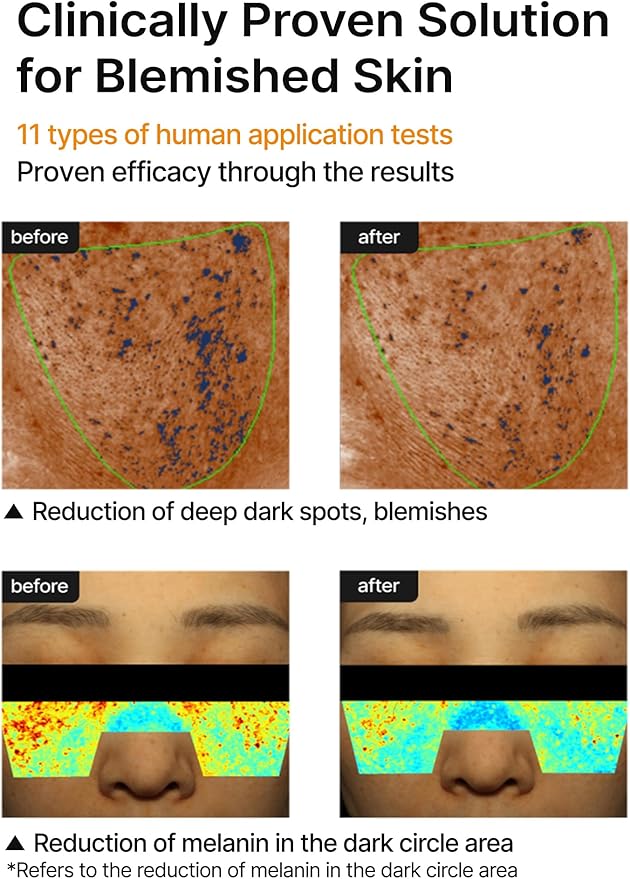 celimax Pore+Dark Spot Brightening Cream