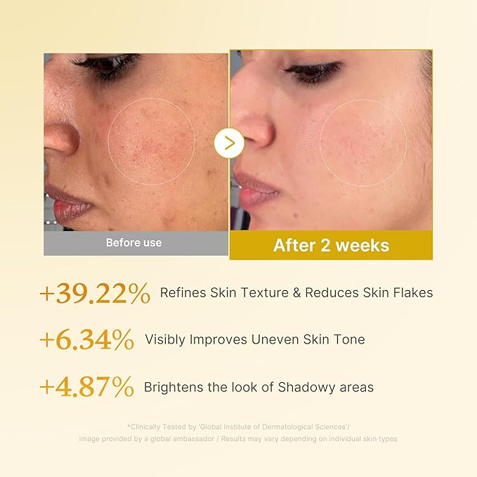 medicube Kojic Acid Turmeric Smoothing Toner for Face & Body | Lightweight Toner for Balancing Uneven Skin Tone