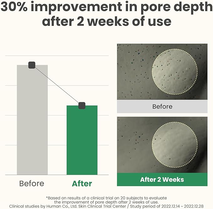 AXIS-Y LHA Peel & Fill Pore Balancing Cream