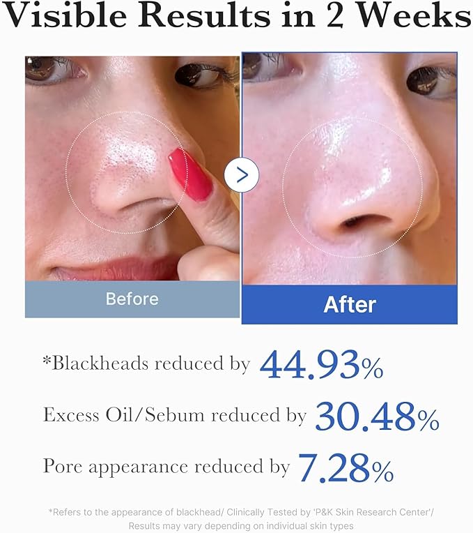 Medicube Zero Pore Pads 2.0 - Dual-Textured Facial Toner Pads for Exfoliation and Minimizing Pores