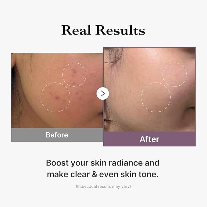 medicube Age-R Glutathione Glow Milky Toner, Low-Irritation Double Layer Toner for Glass Glow Skin with Peptide