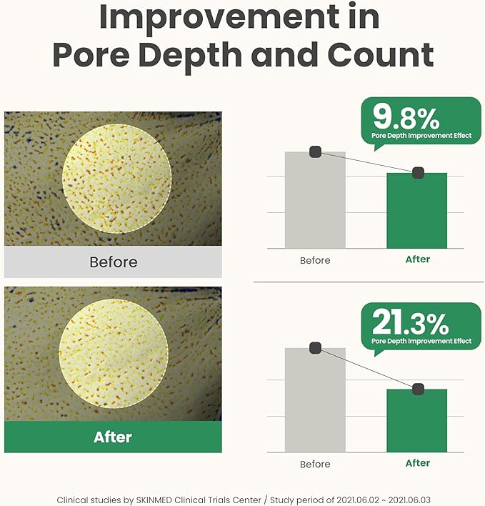 AXIS-Y Mugwort Pore Clarifying Wash Off Pack