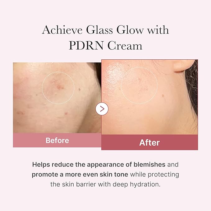Medicube PDRN Pink Hyaluronic Moisturizing Cream 50ml